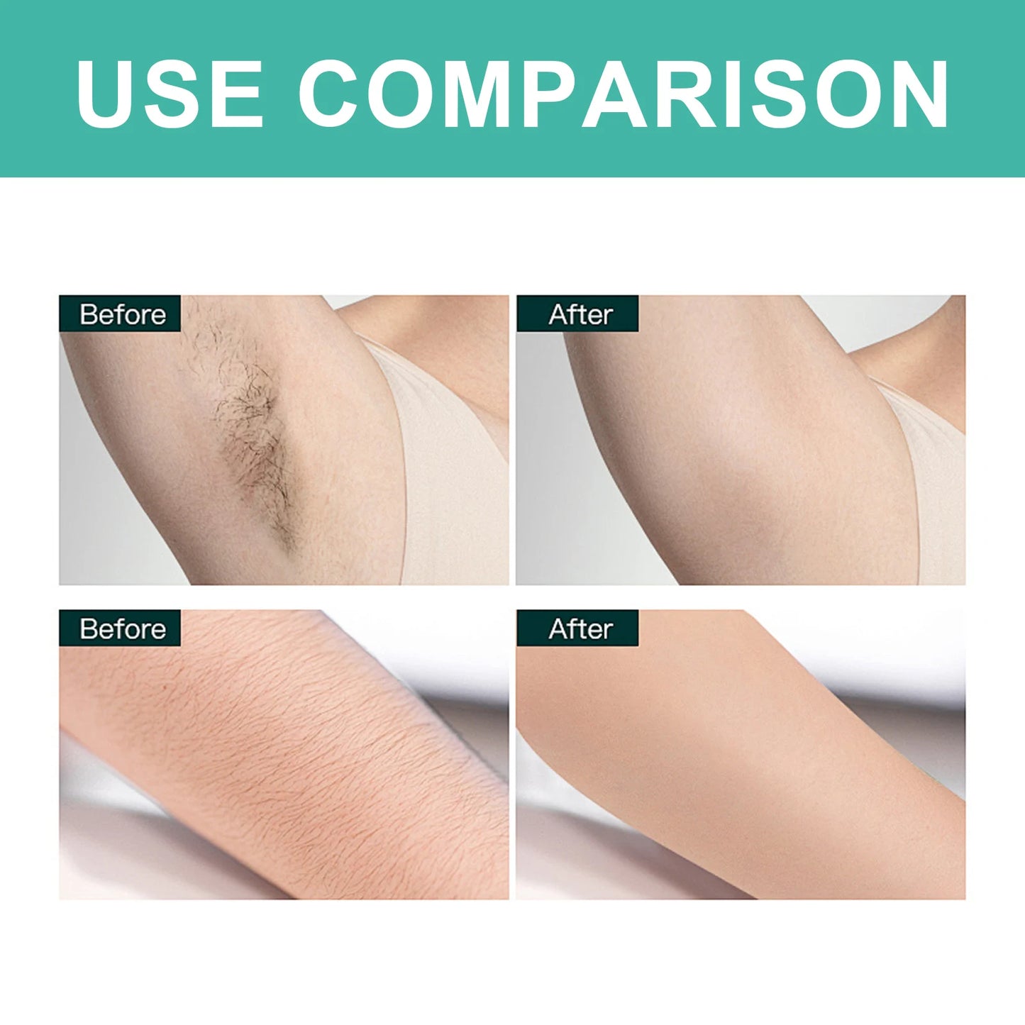 Gentle Hair Removal Wax Patches For All Body Areas Safe